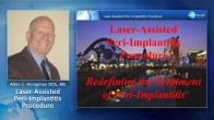 Redefining the Treatment of Peri-Implantitis Webinar Thumbnail